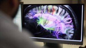 studimi:-truri-i-njeriut-nuk-arrin-pjekurine-deri-ne-moshen-32-vjecare