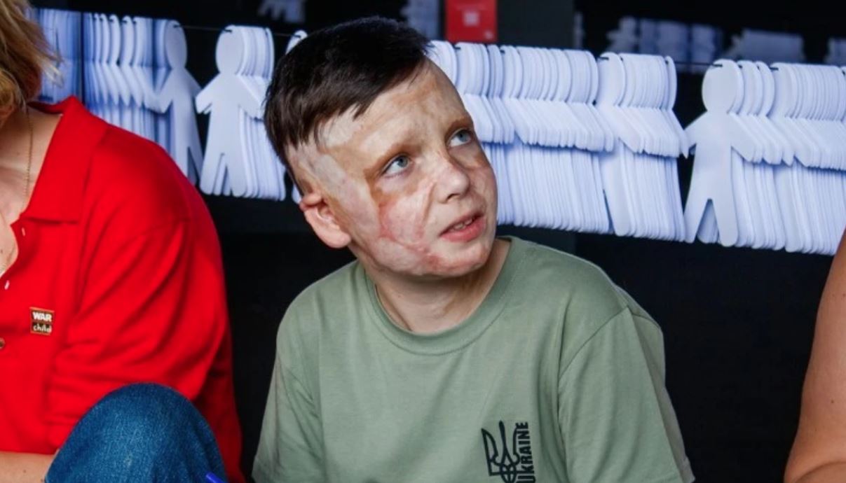 rrefimi-qe-ngriti-ne-kembe-parlamentin-europian,-11-vjecari-ukrainas-qe-i-tha-lamtumire-nenes-nen-rrenoja