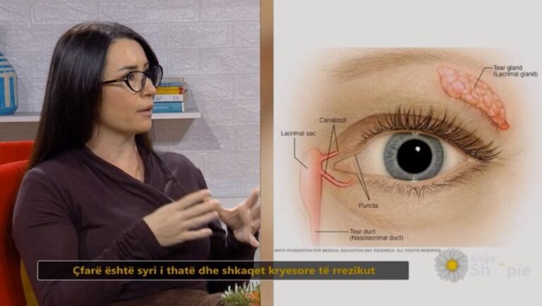 okulistja-tregon-rrezikun-e-fshehur-pas-qerpikeve-false