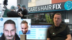 histori-suksesi/-klinika-e-pare-robotike-per-mbjelljen-e-flokeve-ne-shqiptari-e-ballkan,-risite