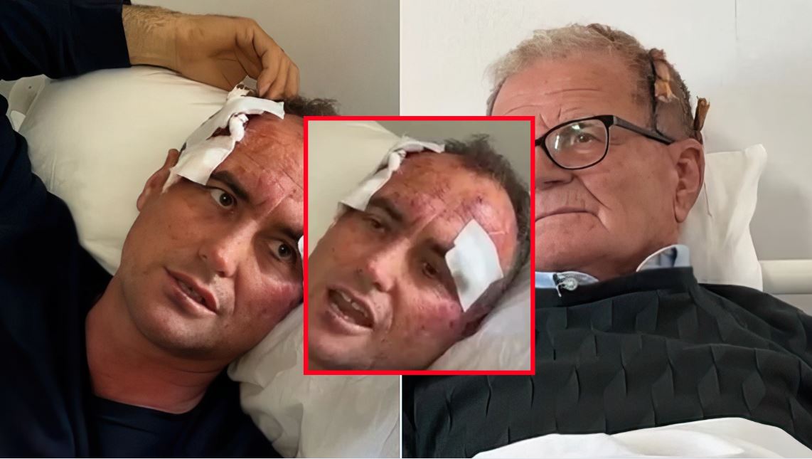 emrat/-“pse-i-bere-like?,-emigranti-46-vjecar-dhe-babai-i-tij-rrihen-nga-fqinji-polic-ne-fier.-efektivi-e-dhunoi-per-komentin-ne-facebook,-ne-profilin-e-motres