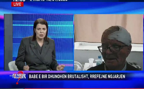 u-dhunua-brutalisht/-i-moshuari-me-plage-ne-koke-rrefen-ngjarjen:-isha-ne-gjume-dhe-degjova-ulerima.-dola,-u-hodha-siper-djalit-per-ta-mbrojtur,-me-goditen-me-shkelma