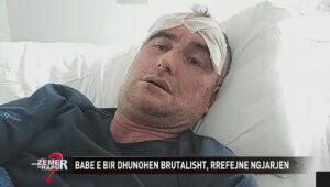 sms-dhe-‘like’-t-ne-fb-e-bashkefshatares-‘molle-sherri’/-“s’e-di-me-ke-je-pleksur!”,-babe-e-bir-u-dhunuan-brutalisht,-46-vjecari:-vellai-i-saj-polic-me-goditi-me-shkop-gome-e-leve-dhe…