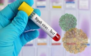 cfare-eshte-virusi-nipah-dhe-pse-po-alarmon-boten?