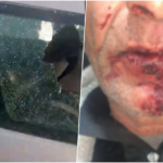 foto-video/-cifti-u-dhunua-brenda-makines-nga-disa-persona-ne-nishtulla,-gruaja-tregon-si-ndodhi-ngjarja:-jemi-ngujuar-ne-shtepi-nga-frika-te-gjithe