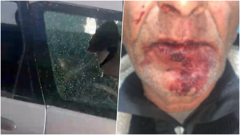 foto-video/-cifti-u-dhunua-brenda-makines-nga-disa-persona-ne-nishtulla,-gruaja-tregon-si-ndodhi-ngjarja:-jemi-ngujuar-ne-shtepi-nga-frika-te-gjithe