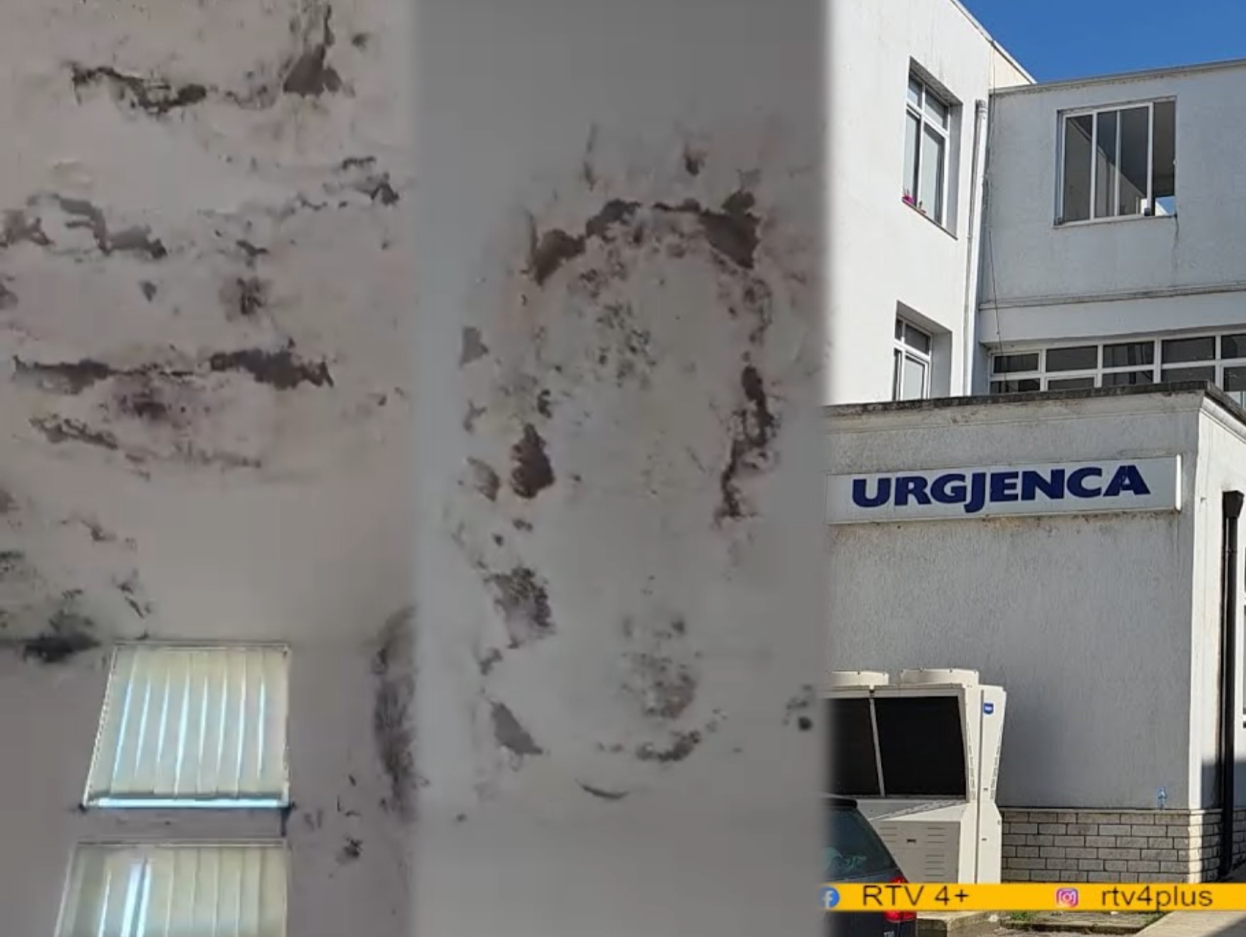 video/-korreshi-ironizon-gjendjen-e-pediatrise-ne-spitalin-e-lushnjes:-merrni-ombrelle-kur-te-shkoni